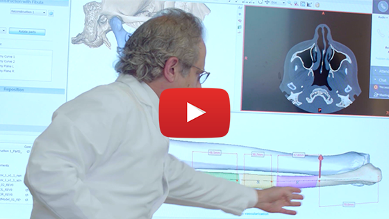 Center for Head and Neck Cancer video screenshot